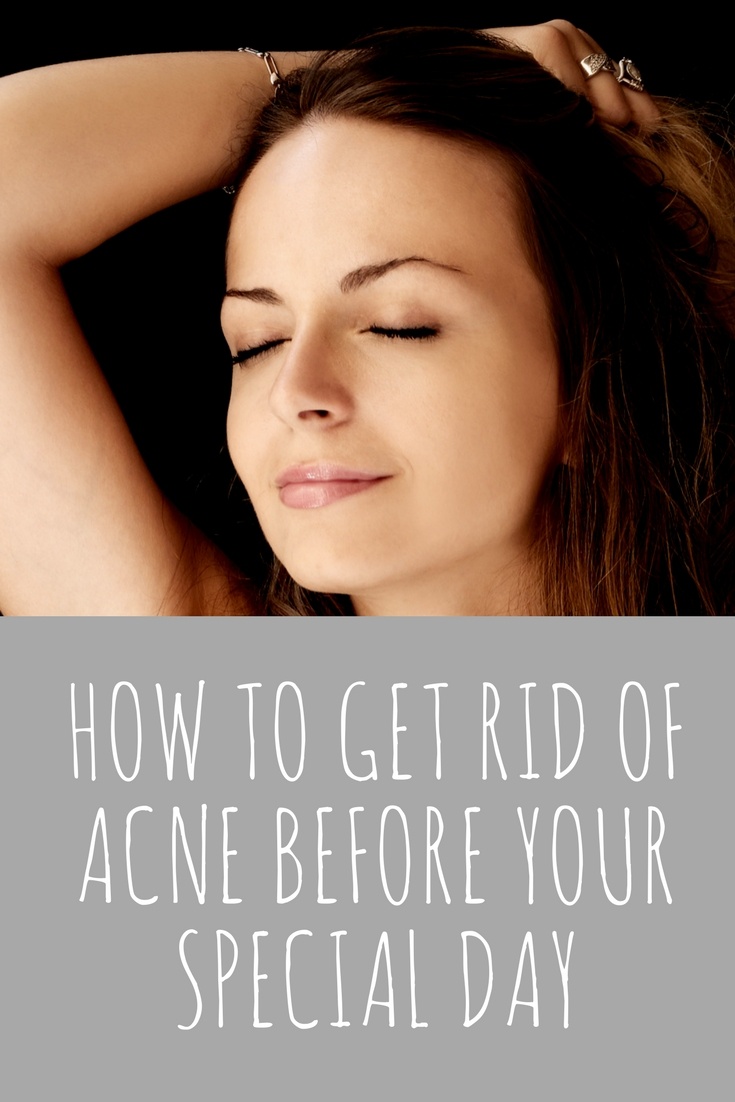 How to Get Rid of Acne